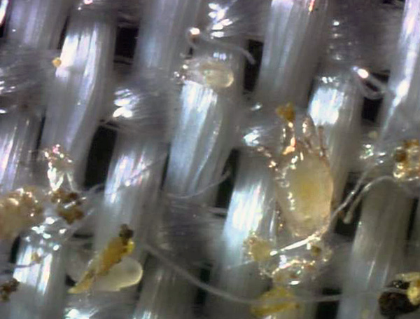 La photo montre des acariens dermatophages parmi les fibres du tissu. La photo montre des acariens dermatophages parmi les fibres du tissu.
