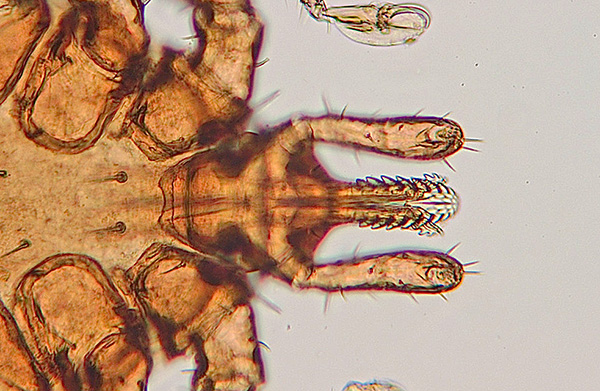Pièces buccales d'une tique au microscope Pièces buccales d'une tique au microscope