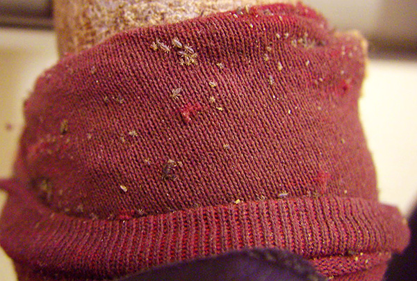 Voici à quoi ressemblent les poux du linge Voici à quoi ressemblent les poux du linge