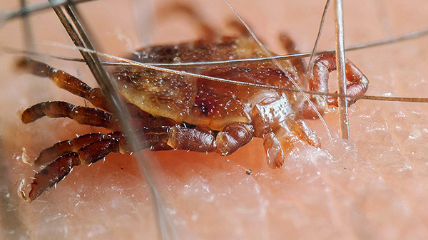 L'infection n'est possible qu'en cas de morsure du parasite ; s'il a simplement rampé sur la peau, cela est sans danger.