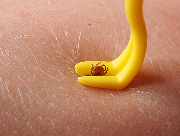 Un outil en plastique pour retirer les tiques en forme de crochet. Un outil en plastique pour retirer les tiques en forme de crochet.
