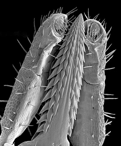 Aspect du rostre de la tique au microscope. Aspect du rostre de la tique au microscope.