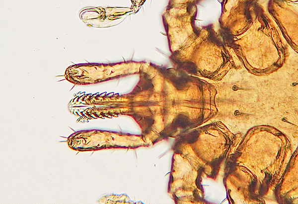 L'appareil buccal du parasite est capable de se fixer très solidement dans la peau de la victime. L'appareil buccal du parasite est capable de se fixer très solidement dans la peau de la victime.
