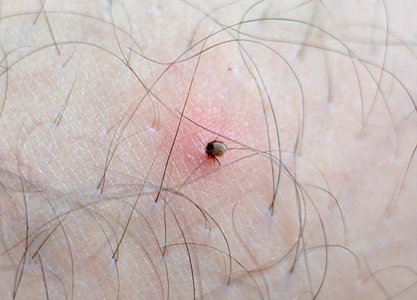 Les tiques ixodides sont vectrices de toute une série de maladies dangereuses. Les tiques ixodides sont vectrices de toute une série de maladies dangereuses.