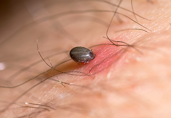 Certaines espèces d'acariens parasitiformes font l'objet d'une attention particulière, car elles sont vectrices de maladies dangereuses. Certaines espèces d'acariens parasitiformes font l'objet d'une attention particulière, car elles sont vectrices de maladies dangereuses.