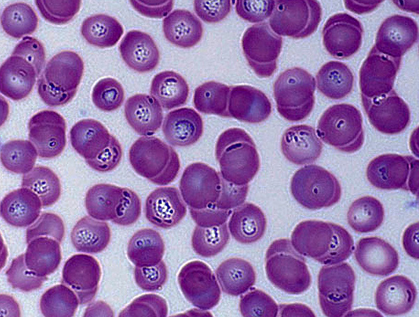 Voici à quoi ressemble le sang d'un chien atteint de piroplasmose au microscope - les piroplasmes sont bien visibles dans les globules rouges. Voici à quoi ressemble le sang d'un chien atteint de piroplasmose au microscope - les piroplasmes sont bien visibles dans les globules rouges.
