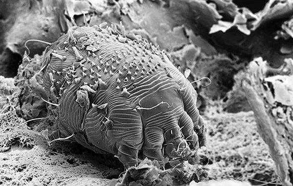 L'acarien de la gale au microscope