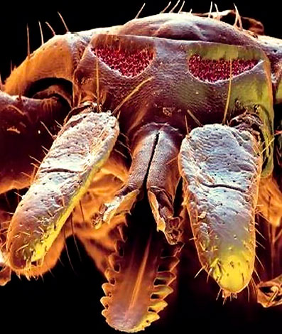 Voici à quoi ressemble l'appareil buccal de la tique des prés