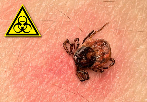 Nous examinons en détail les infections transmises par les tiques : modes de transmission, caractéristiques de l'évolution de la maladie et méthodes de traitement efficaces... Nous examinons en détail les infections transmises par les tiques : modes de transmission, caractéristiques de l'évolution de la maladie et méthodes de traitement efficaces...
