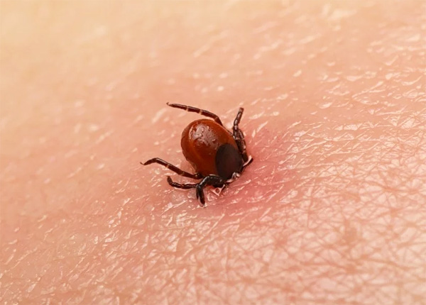 Nous découvrons quelles peuvent être les conséquences d'une morsure de tique pour la santé humaine... Nous découvrons quelles peuvent être les conséquences d'une morsure de tique pour la santé humaine...
